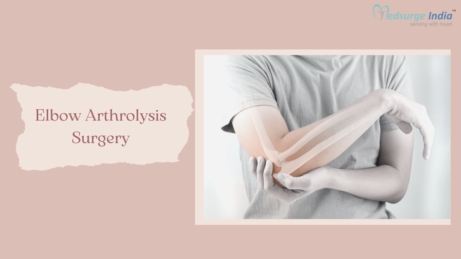 Arthrolysis Surgery Cost In India