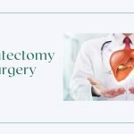 Hepatectomy Surgery in India
