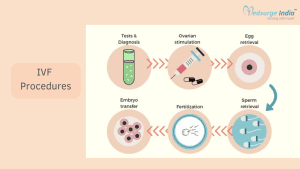 Procedures to Perform IVF Successfully