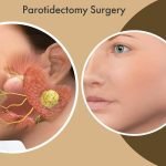 parotidectomy surgery in India