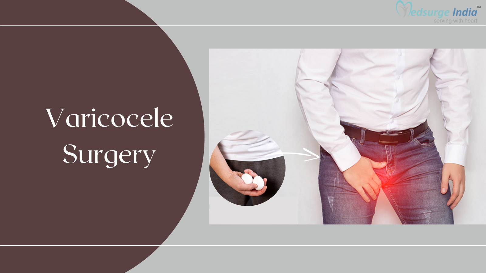 A Guide to Varicocele Treatment in Singapore