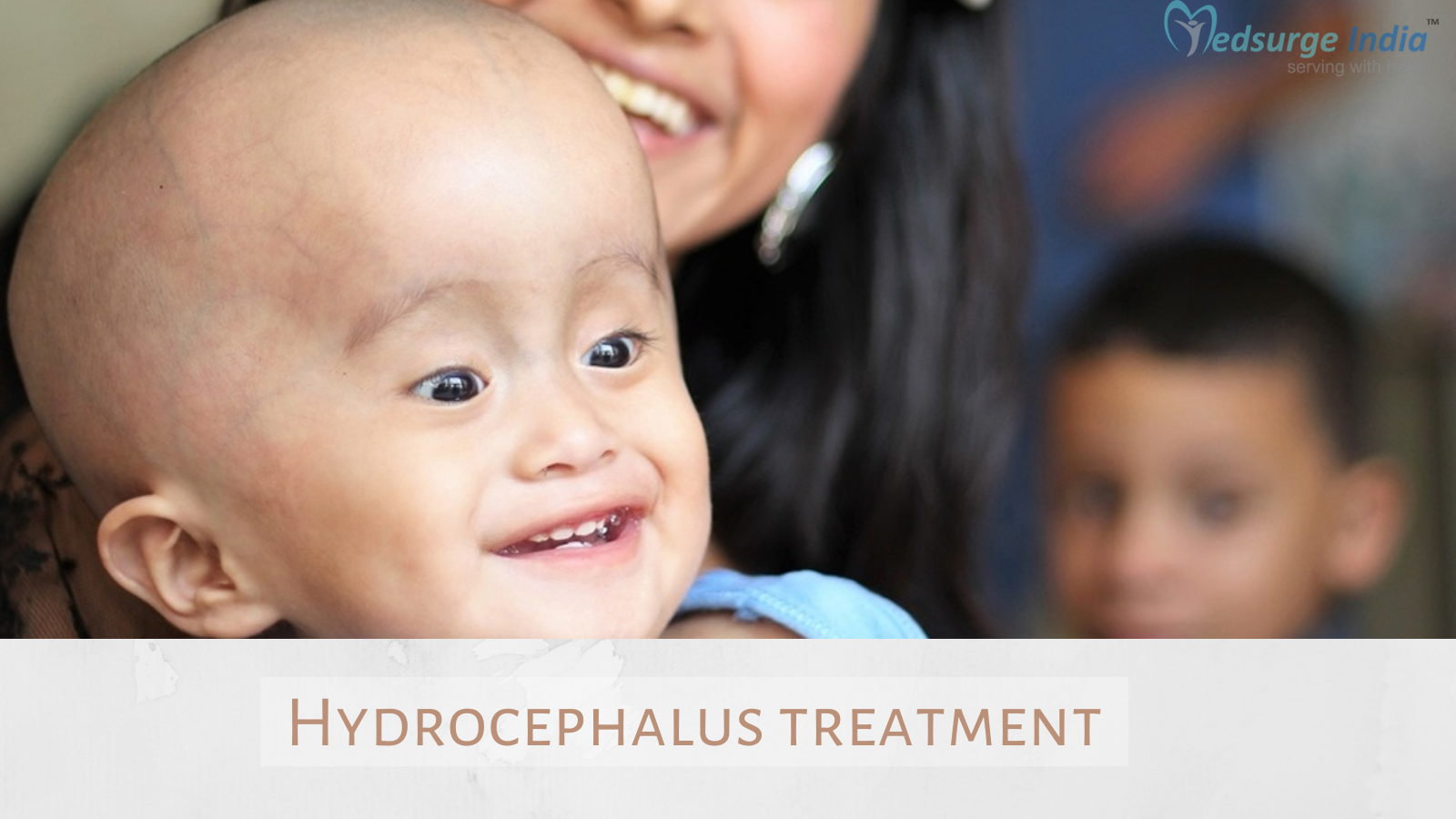 hydrocephalus after treatment