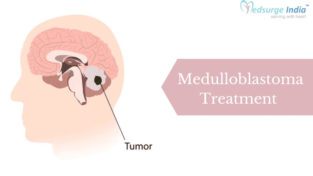 Medulloblastoma treatment in India