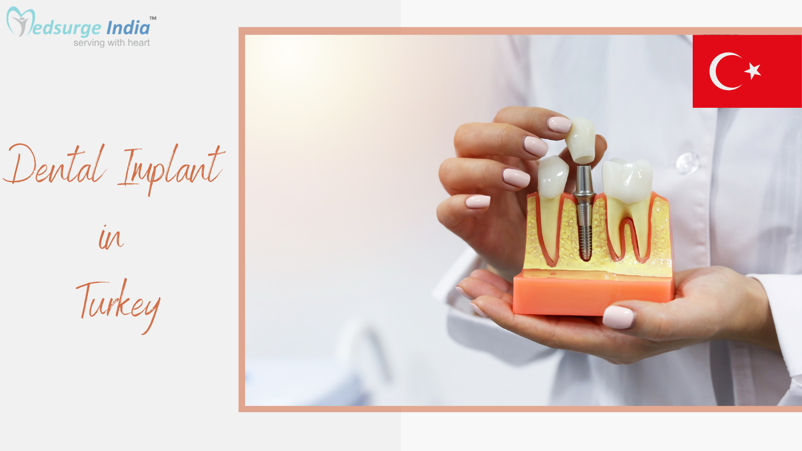 Dental Implant Cost In Turkey