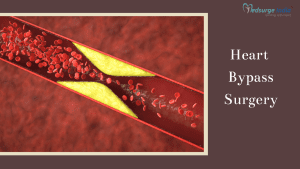 Heart Bypass Surgery Cost in Medanta