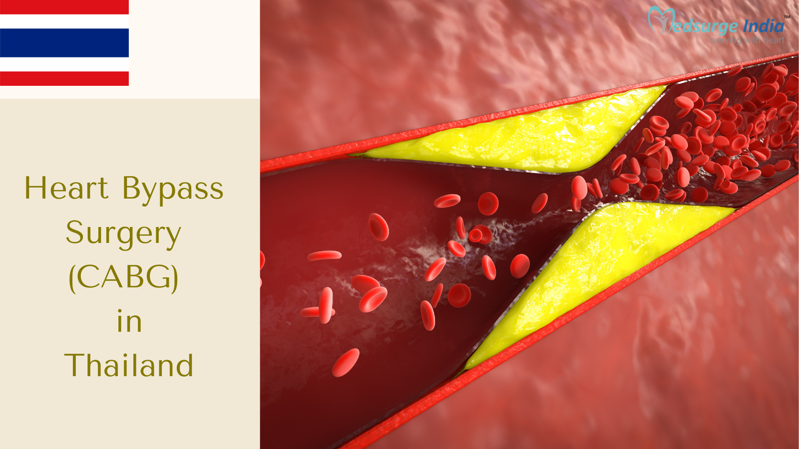 Heart Bypass Surgery (CABG) Cost in Thailand
