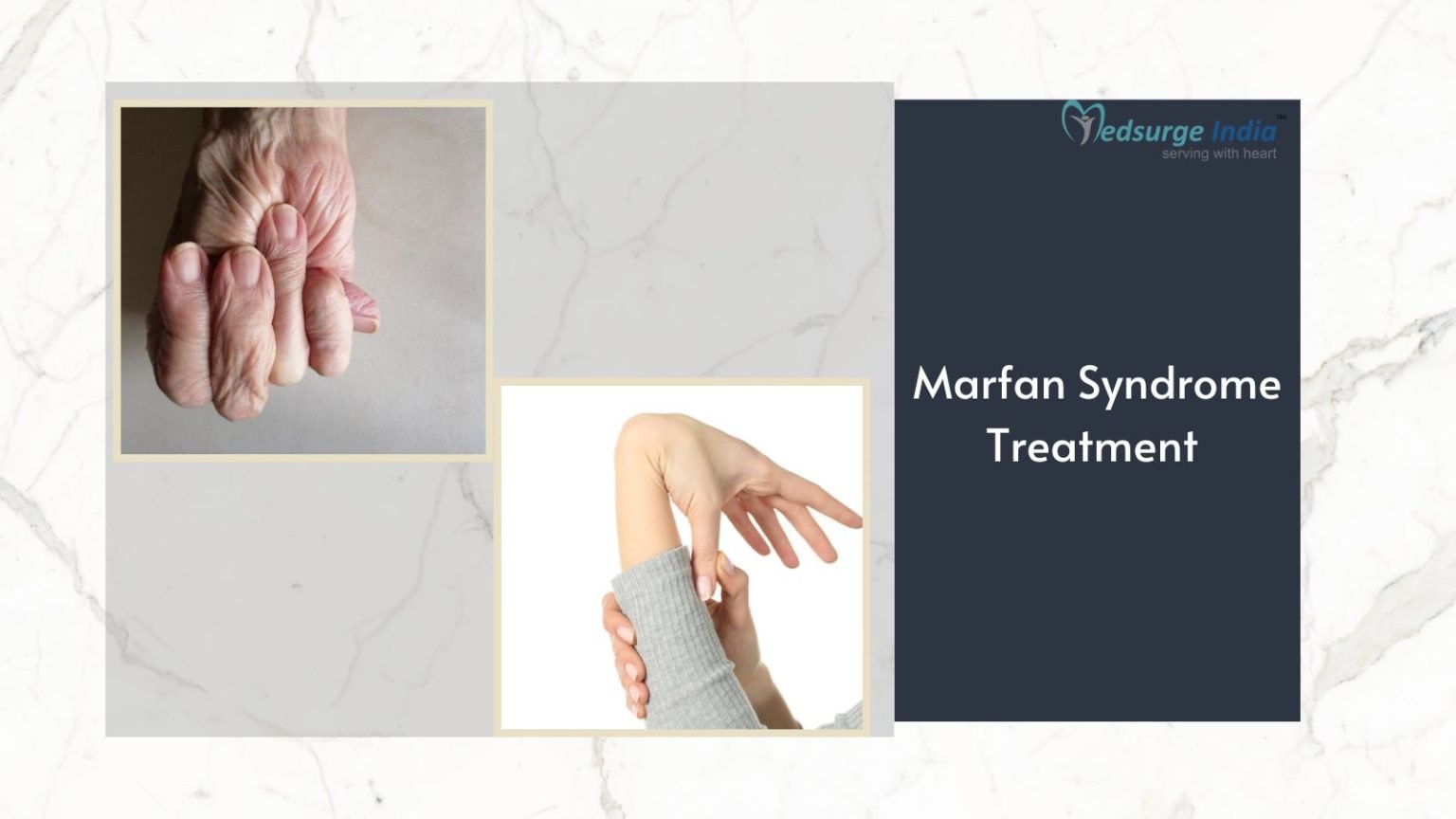 Marfan Syndrome Treatment Cost In India Treament And Procedure Medsurge India