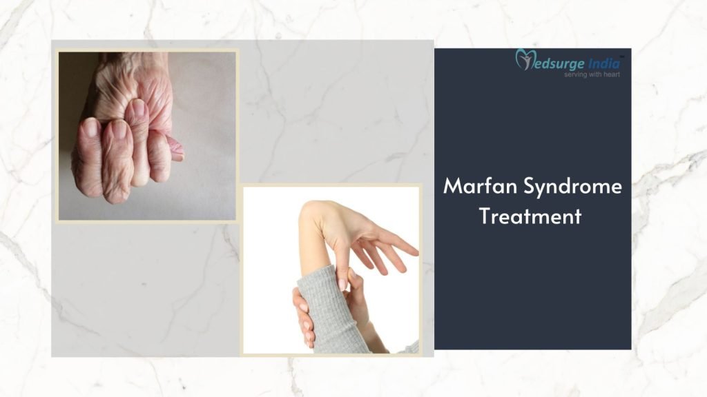 Marfan Syndrome Treatment Cost In India | Treament & Procedure ...
