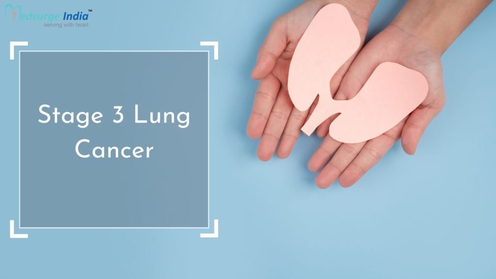 stage-3-lung-cancer-treatment-cost-in-india