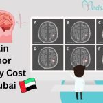 Brain Tumor Surgery Cost in Dubai