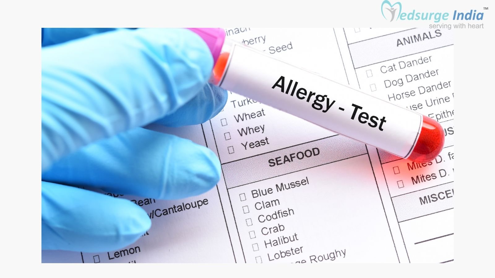 seasonal allergy diagnosis