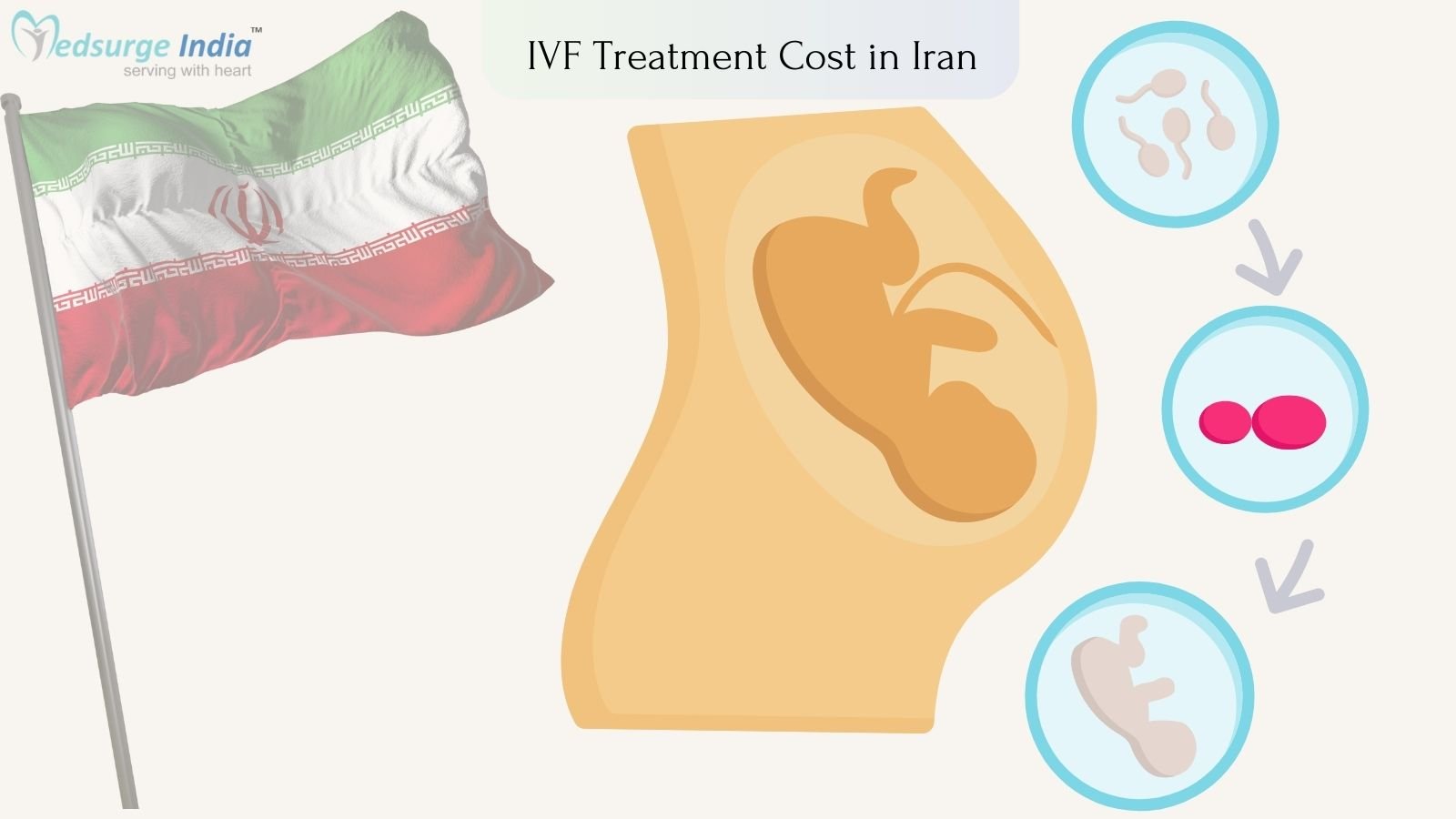 IVF Treatment Cost in Iran