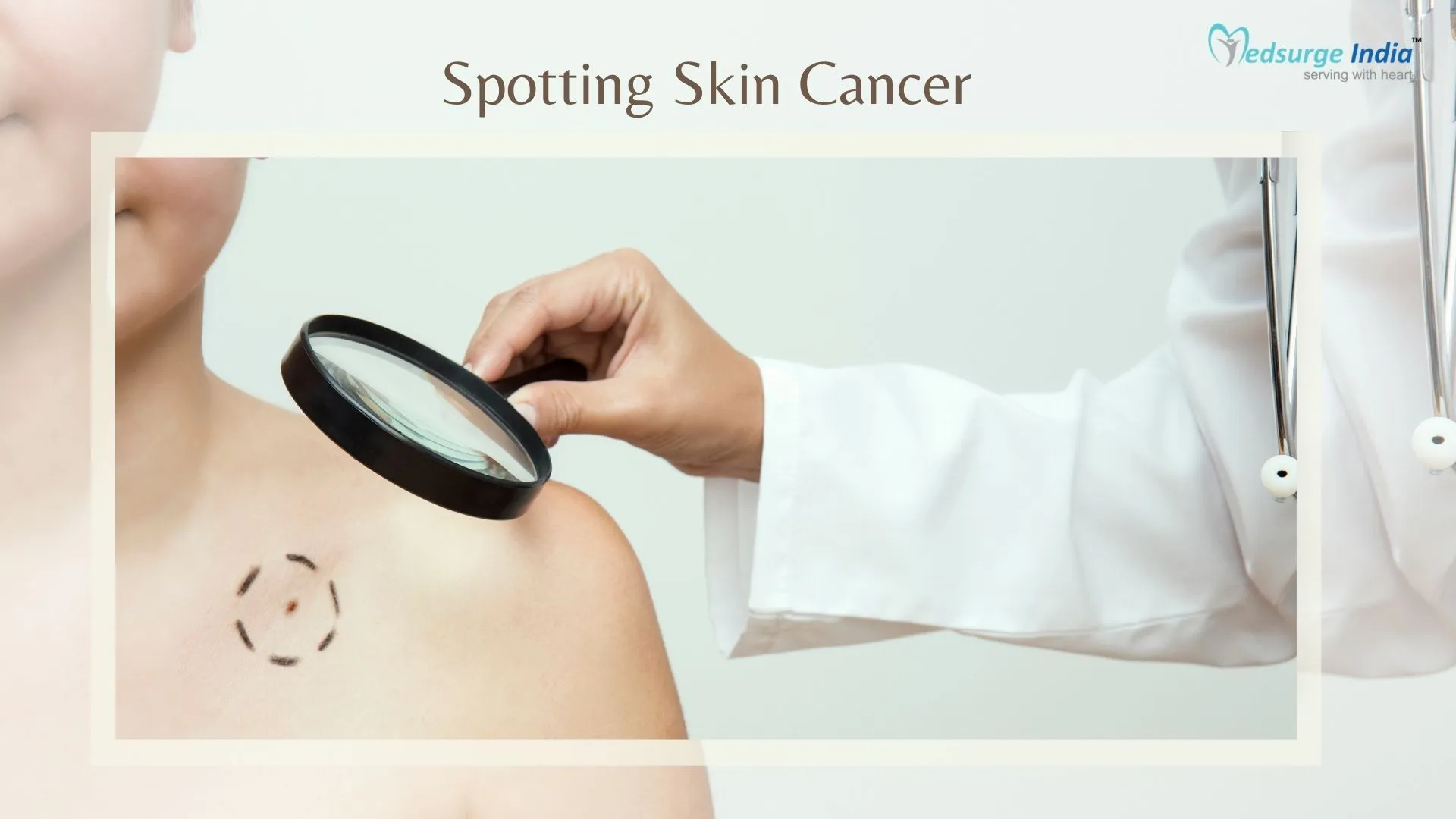Spotting Skin Cancer: Know the Warning Signs