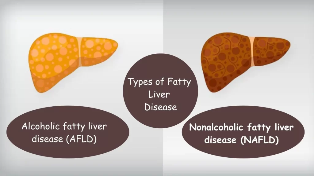 types of fatty liver disease