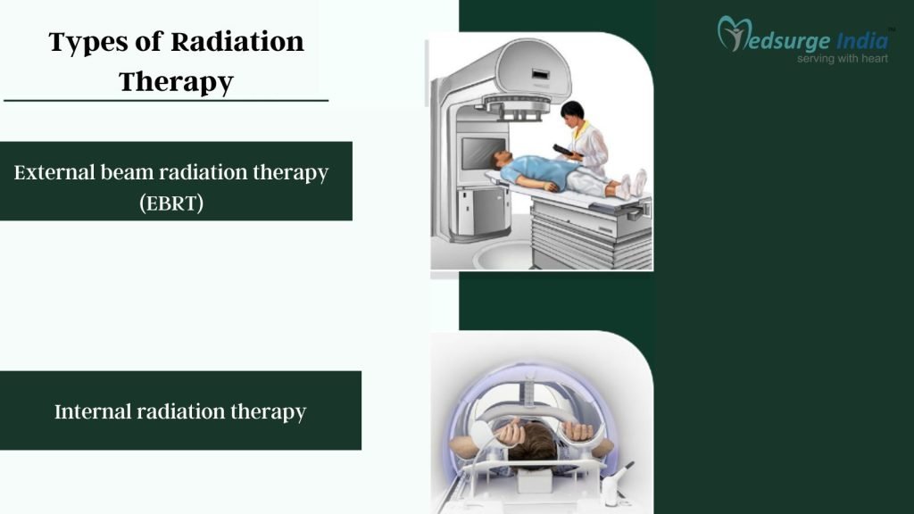 Types of Radiation Therapy