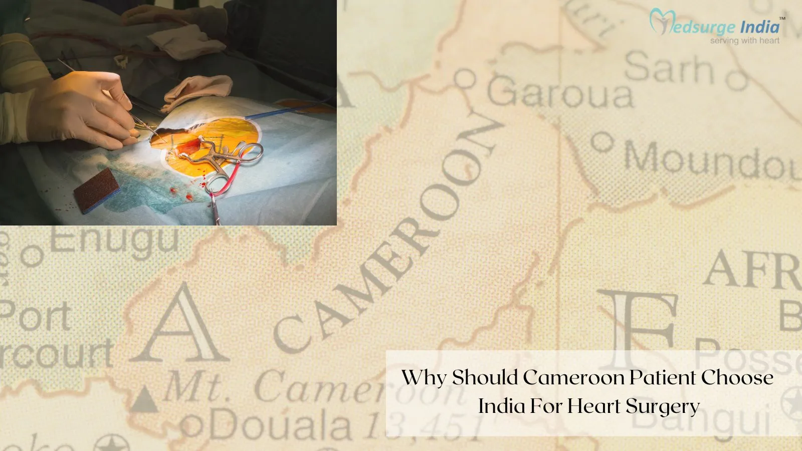 Why Should Cameroon Patient Choose India For Heart Surgery