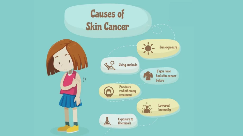 Causes of Skin Cancer