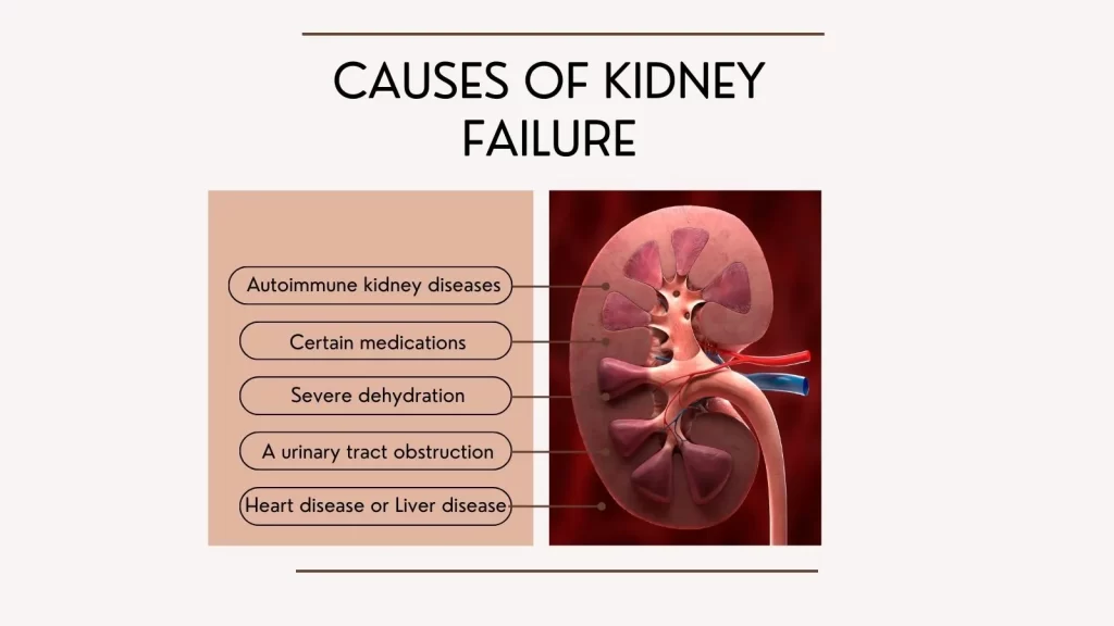 Causes of Kidney (Renal) Failure
