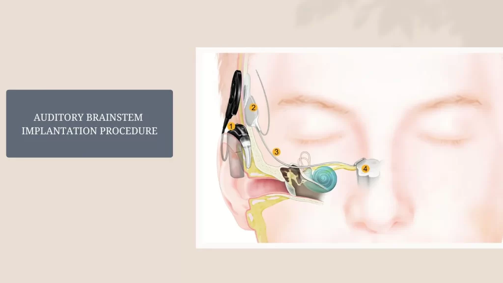 Auditory Brainstem Implantation Procedure