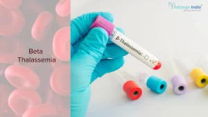 Beta Thalassemia
