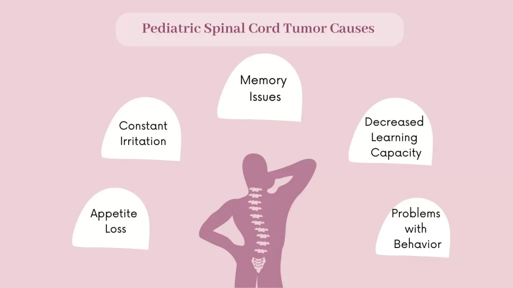 Pediatric Spinal Cord Tumor Symptoms