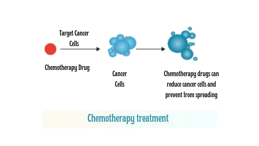 Chemotherapy For Acute Lymphocytic Leukemia