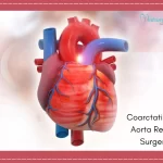 Coarctation of Aorta Repair Surgery Cost in India