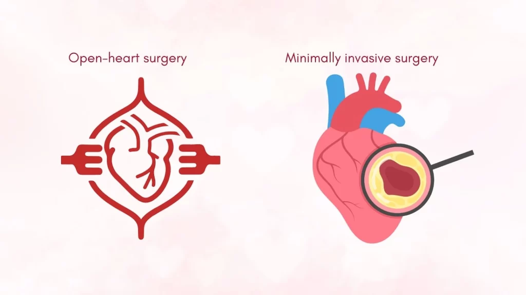Open heart surgery 