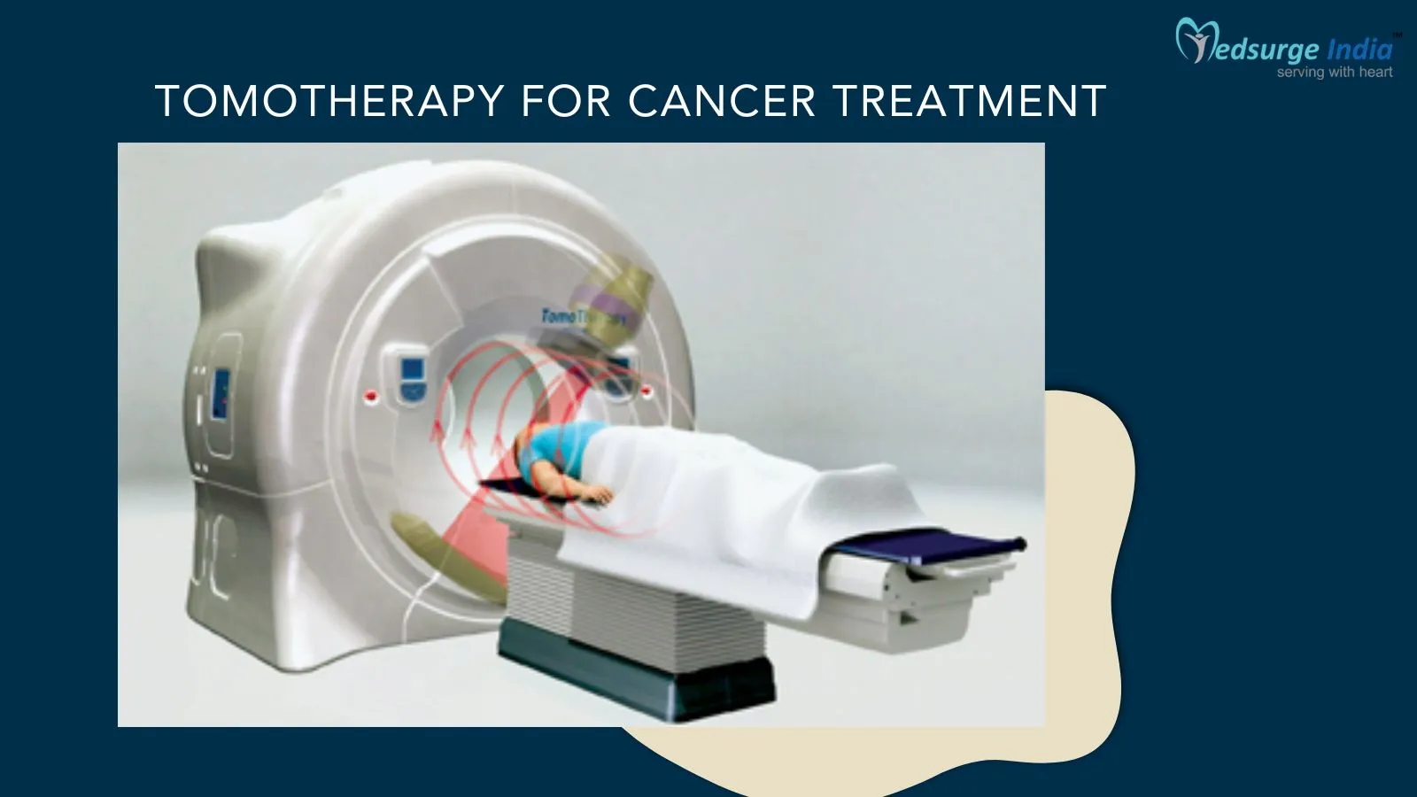 Tomotherapy For Cancer Treatment