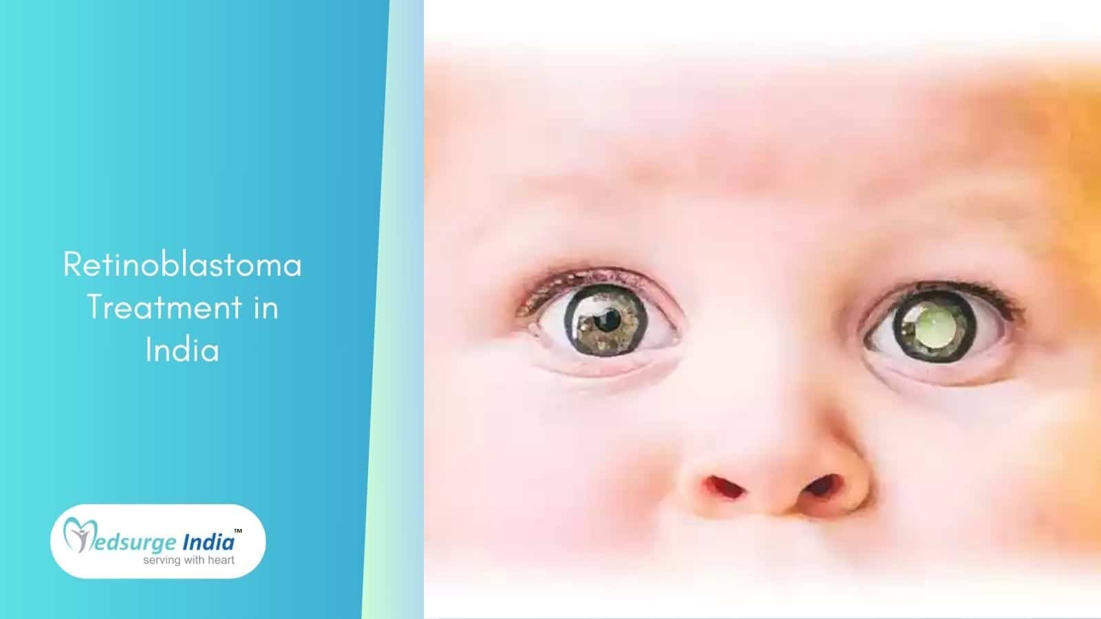 Retinoblastoma Treatment Cost In India Medsurge India