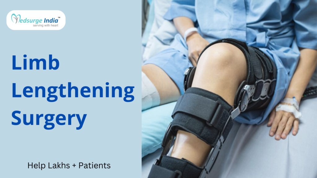 limb-lengthening-surgery-cost-in-uae