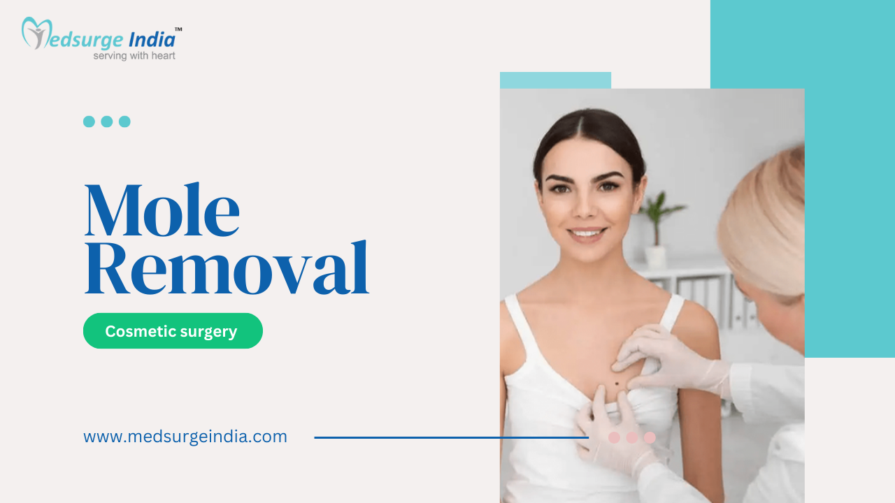 mole-removal-cost-in-india