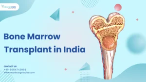 Bone Marrow Transplant in India