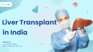 Liver Transplant in India