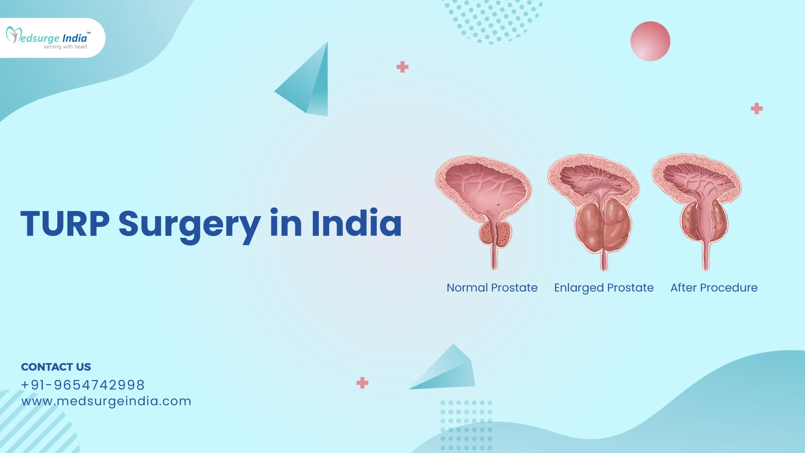 TURP Surgery Cost in India