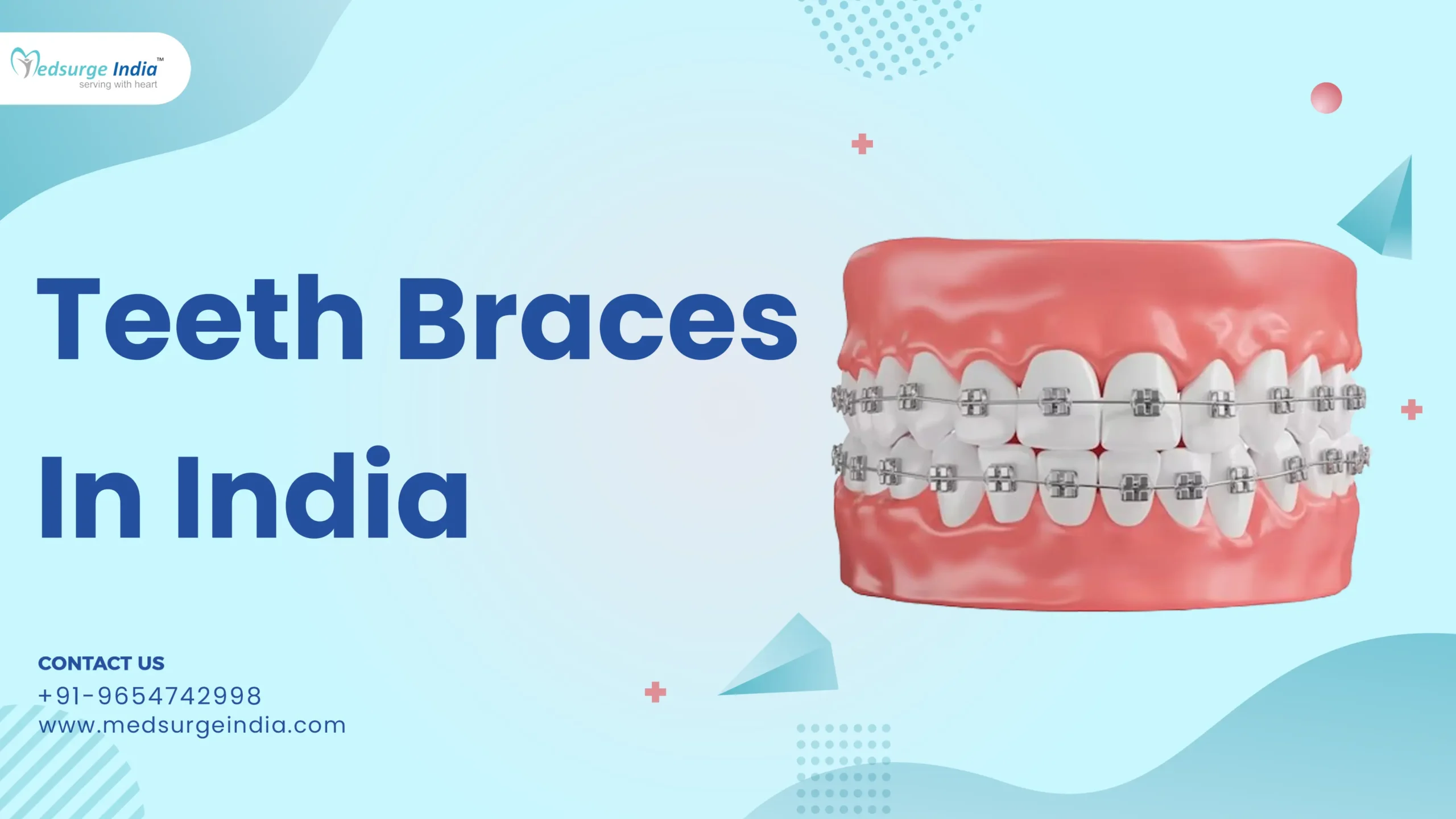 Teeth Braces Cost in India