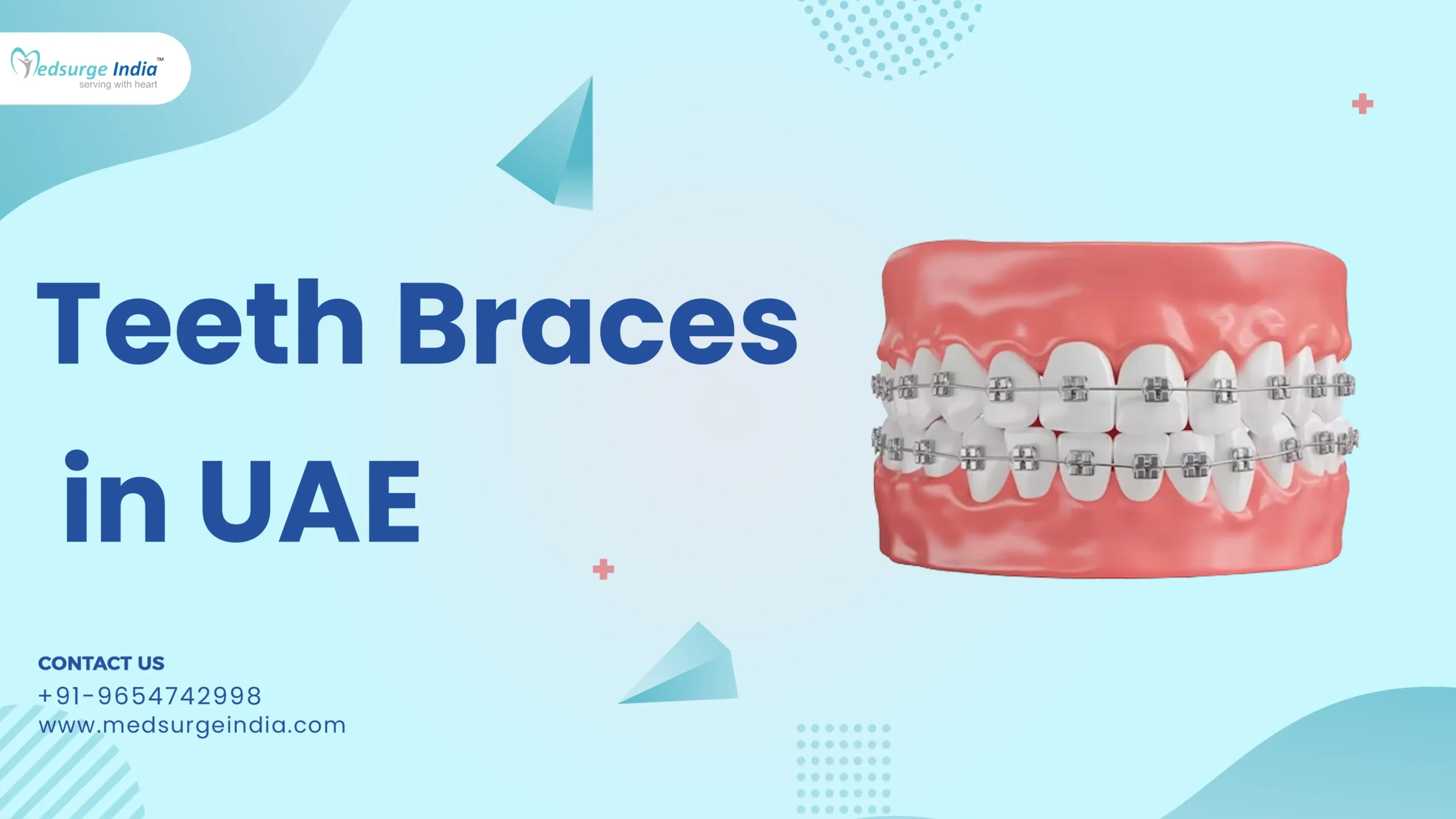 Teeth Braces Cost in UAE