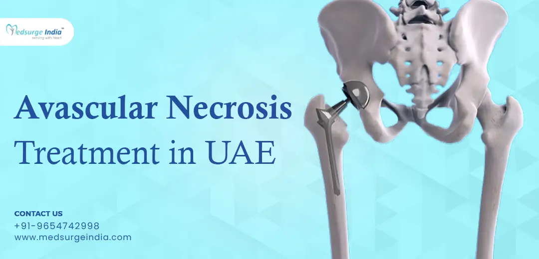 Avascular Necrosis Treatment Cost in UAE