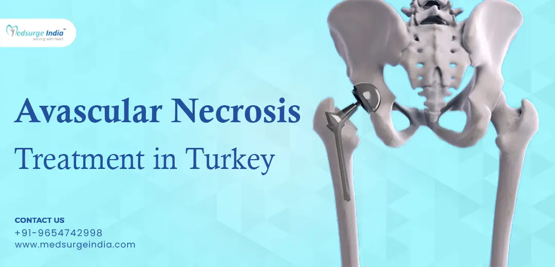 Avascular Necrosis Treatment Cost in Turkey