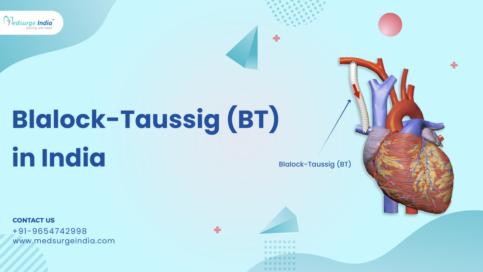 Blalock-Taussig (BT) Shunt Cost in India