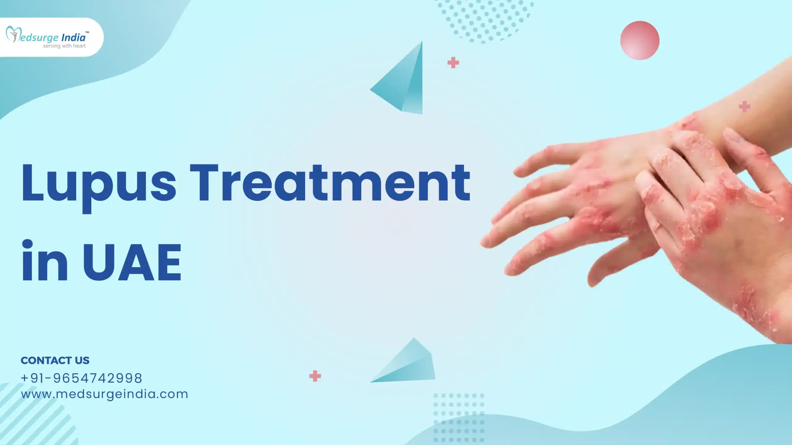 Lupus Treatment Cost in UAE