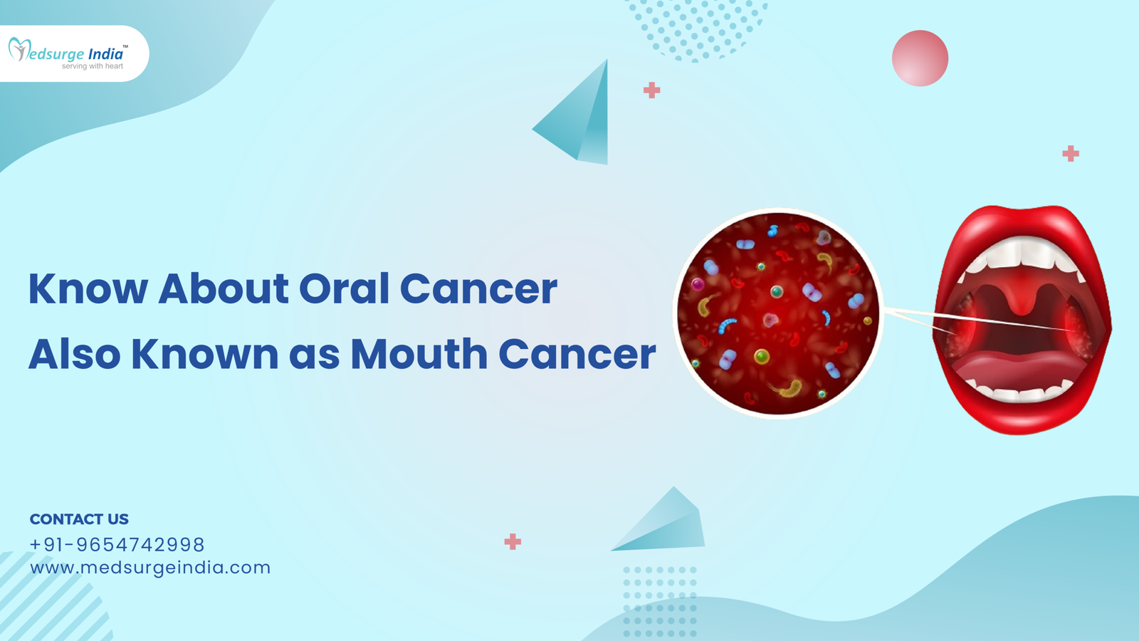 Know About Oral Cancer Also Known as Mouth Cancer