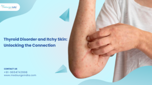 Thyroid Disorder and Itchy Skin