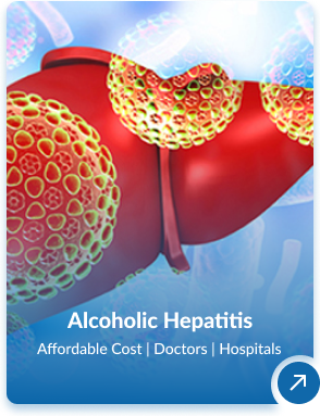 Hepatology in India