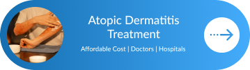 Dermatology Treatment In India