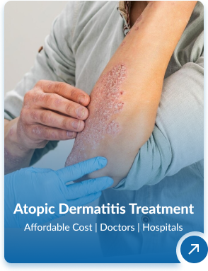 Dermatology Treatment In India