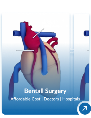 Cardiology and Cardiac Surgery in India