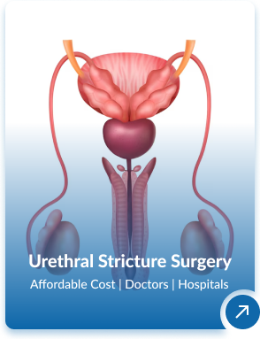Urology Treatment In India