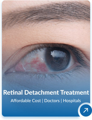 Ophthalmology Treatment In India