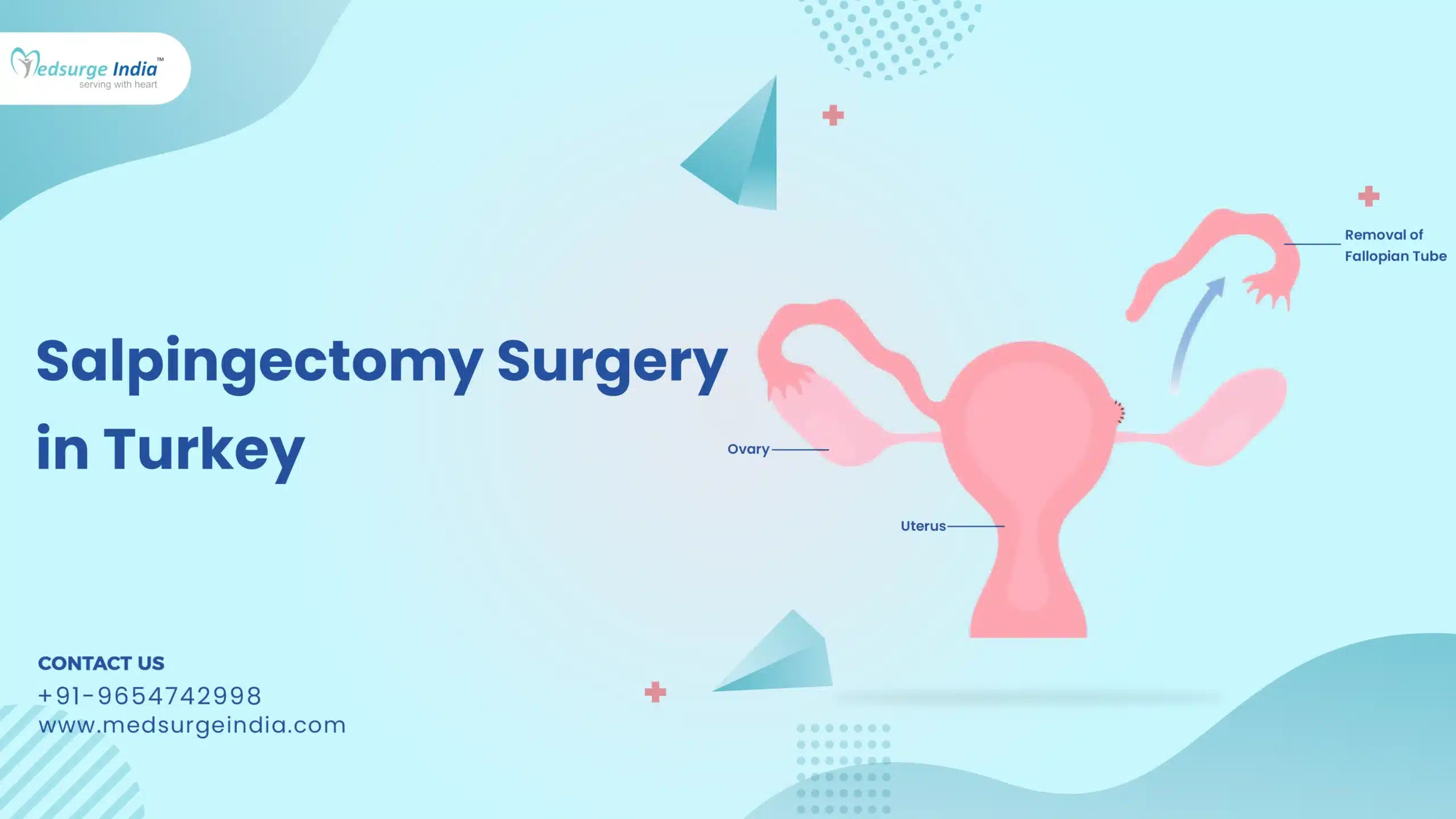 Salpingectomy Surgery Cost In Turkey